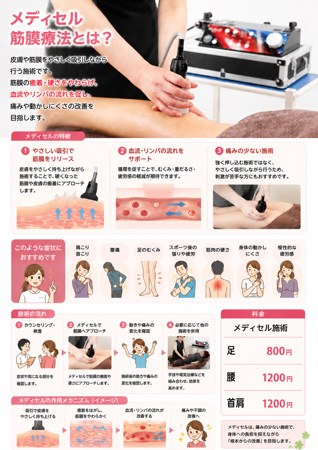 メディセル筋膜療法の説明画像